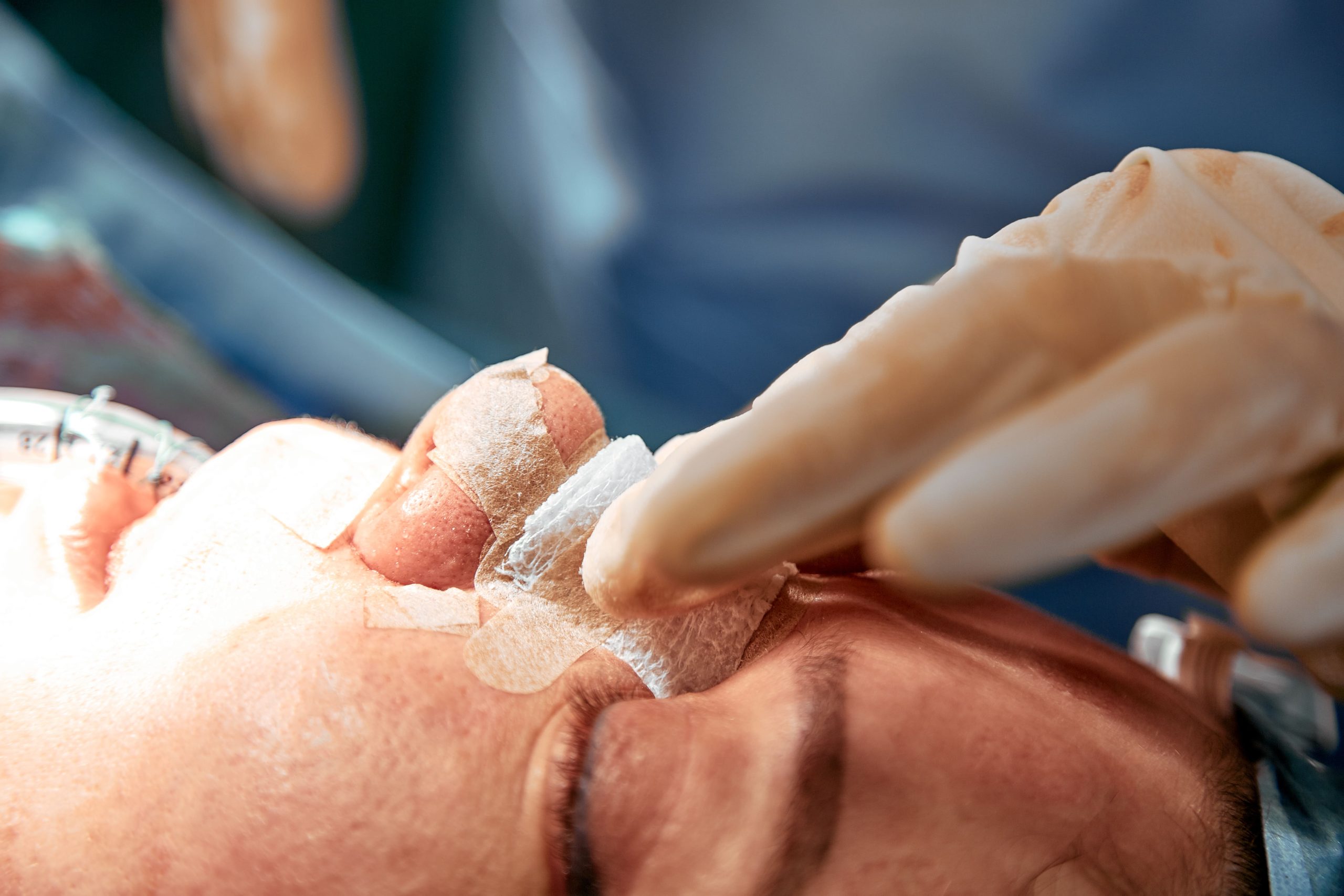 Cuánto cuesta una rinoplastia: precios en España
