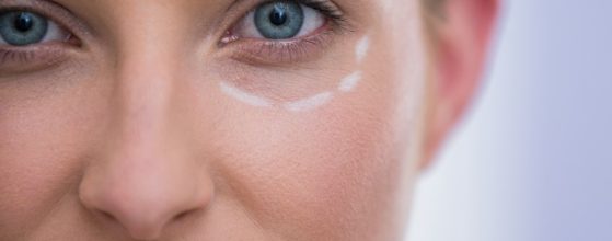 blefaroplastia mal hecha