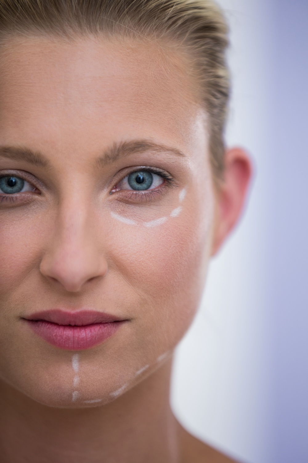 Blefaroplastia Mal Hecha: Cómo Identificarla y la Solución