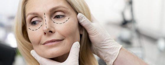 Ptosis o párpado caído