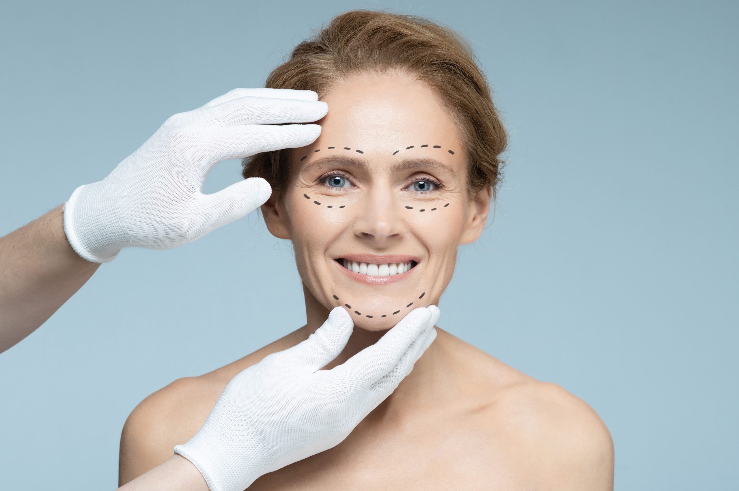 Lifting facial personalizado:  La clave para un rejuvenecimiento con apariencia natural y adaptado a ti