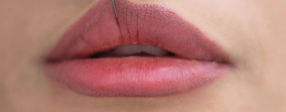 Lipofilling de labios
