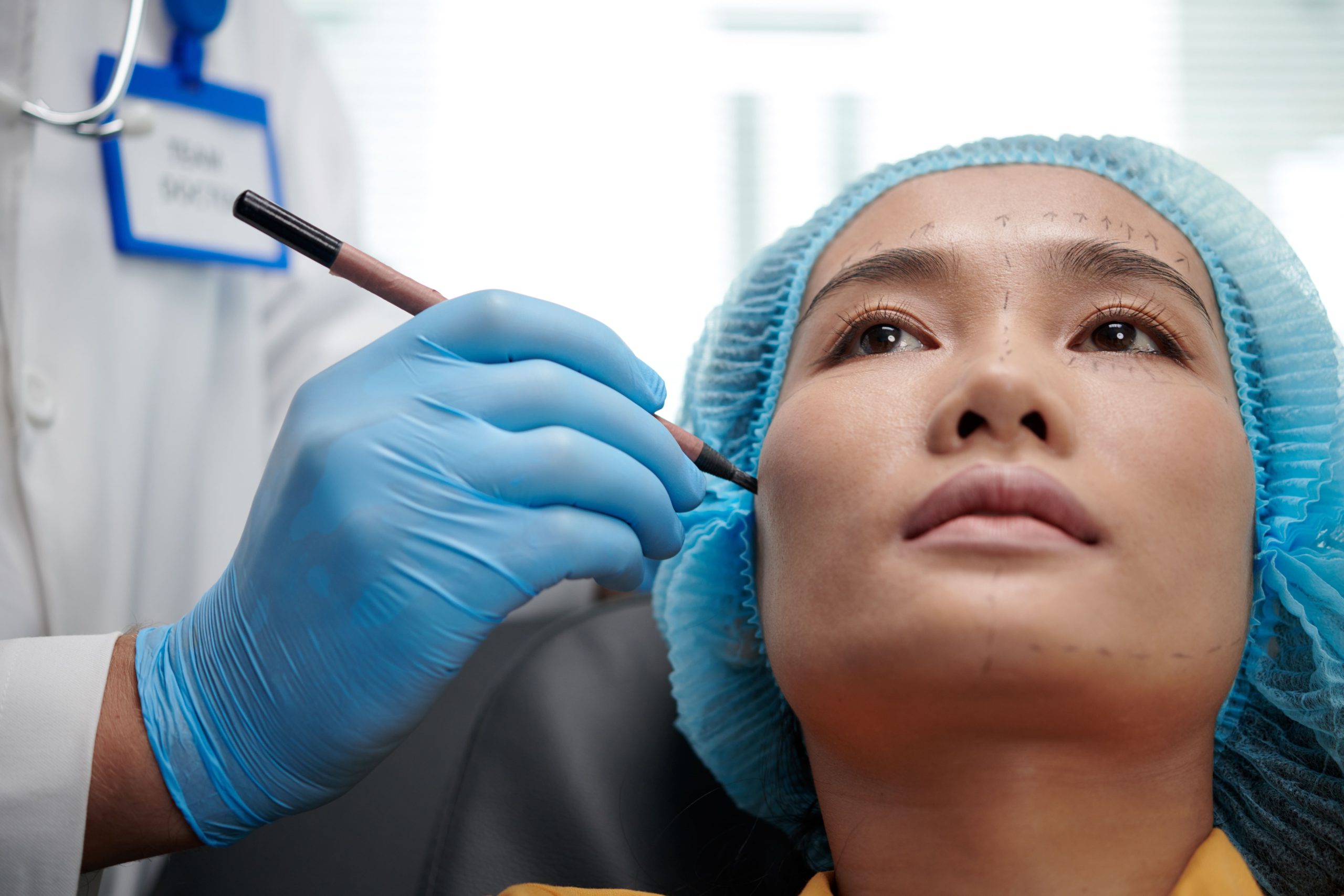 Aumento de Pómulos con Implantes Malares: Recuperación, Cuidados y Resultados Duraderos que Debes Conocer