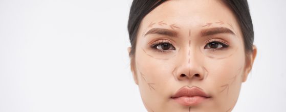 asimetría facial severa