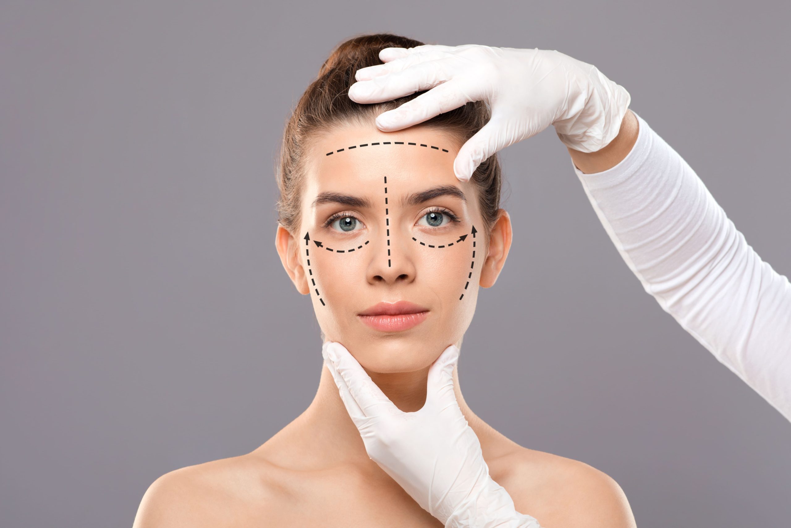 Lifting SMAS: cómo lograr un rejuvenecimiento facial natural que realmente perdura
