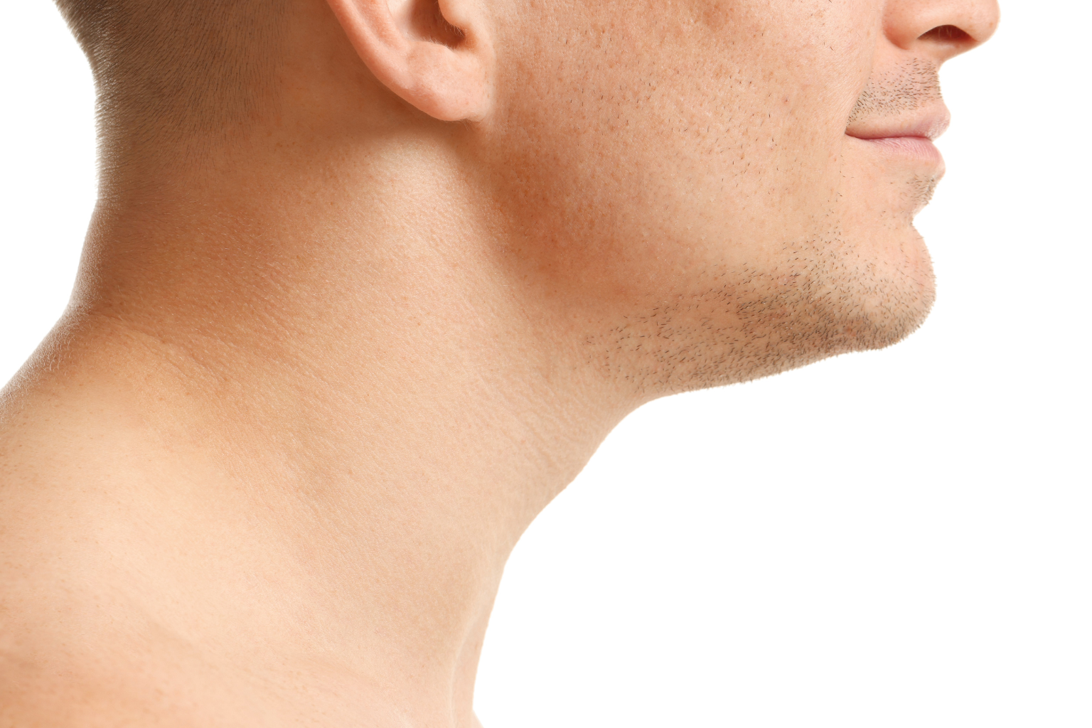 ¿Nariz grande o mentón pequeño? Cómo la mentoplastia de aumento define tu perfil