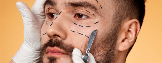 Masculinización facial en Madrid realizada por la Dra. Silvia Rosón para armonizar y definir los rasgos faciales de forma natural.