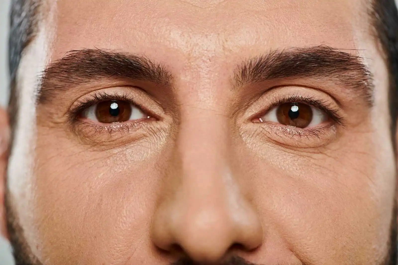 Blefaroplastia en hombres, antes y después: cómo interpretar el resultado real