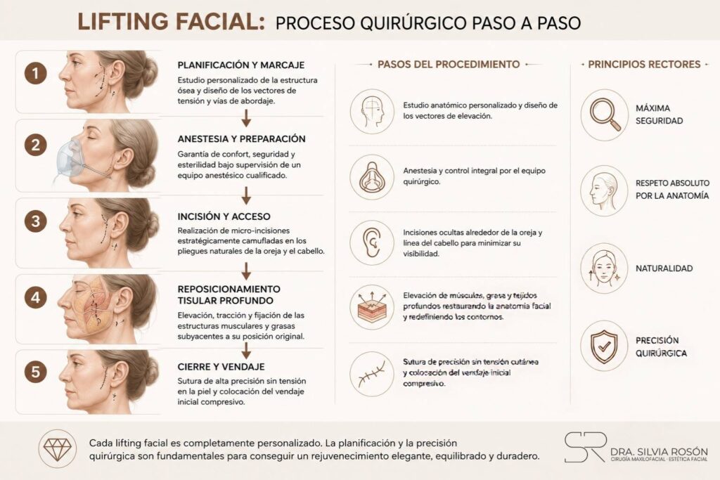 Infografía del proceso quirúrgico del lifting facial paso a paso: planificación, anestesia, incisión, reposicionamiento del SMAS y cierre