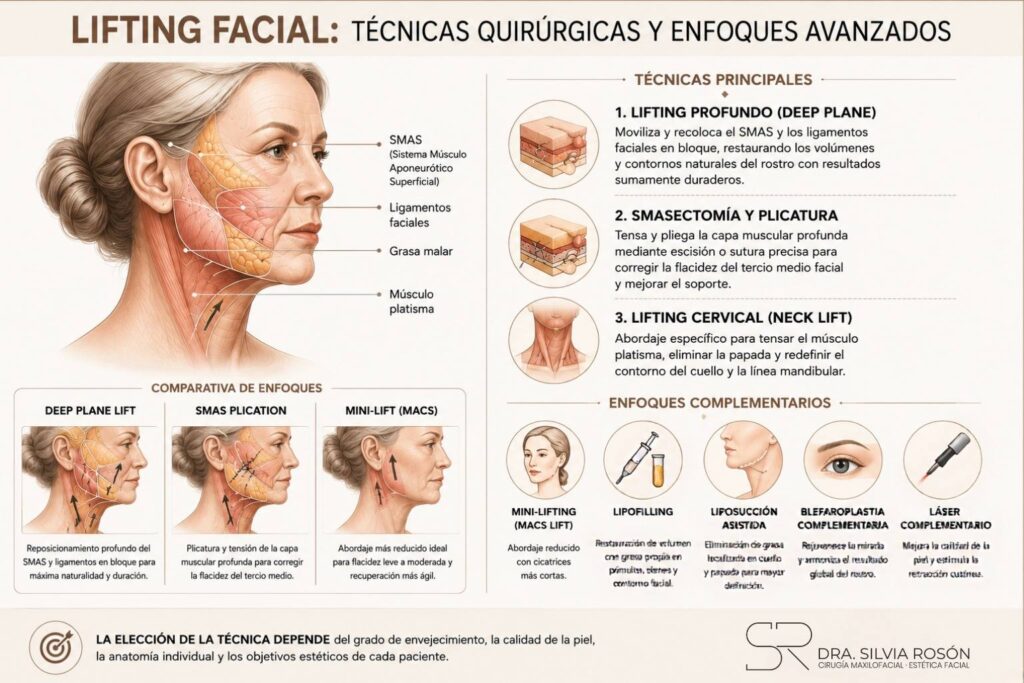 Infografía de técnicas de lifting facial: deep plane, SMASectomía y plicatura, lifting cervical, y enfoques complementarios como lipofilling y blefaroplastia
